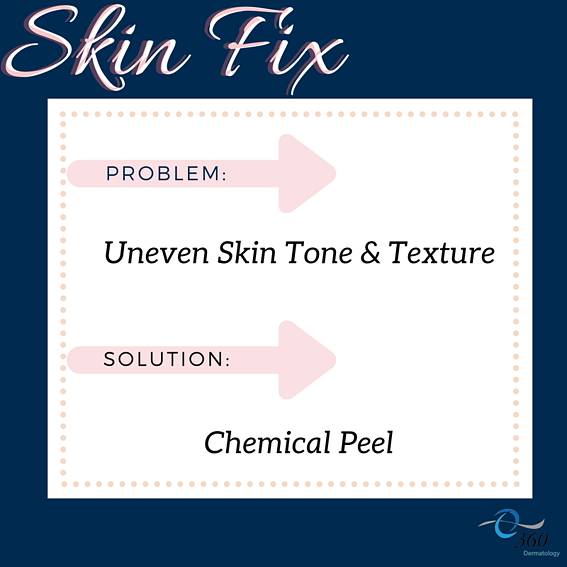 Chemical Peel