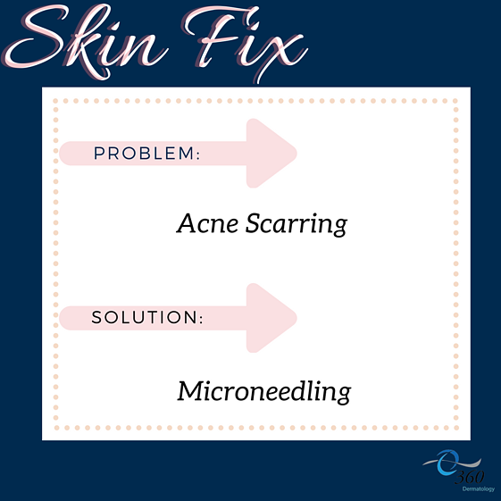 Microneedling