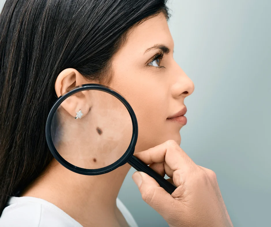 how-common-is-skin-cancer-at-what-age-does-skin-cancer-typically-occur